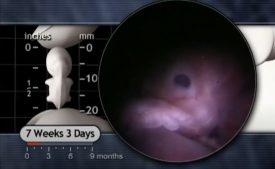 Show People Who the Unborn Child Is 7 weeks fetus revealed